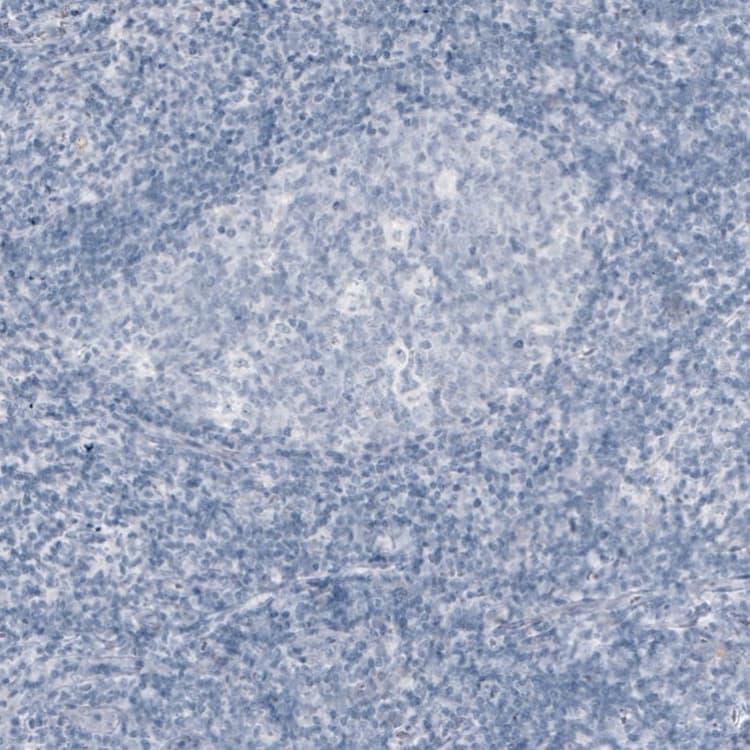 Anti-Myelin oligodendrocyte glycoprotein antibody [CL2858](AB242374)