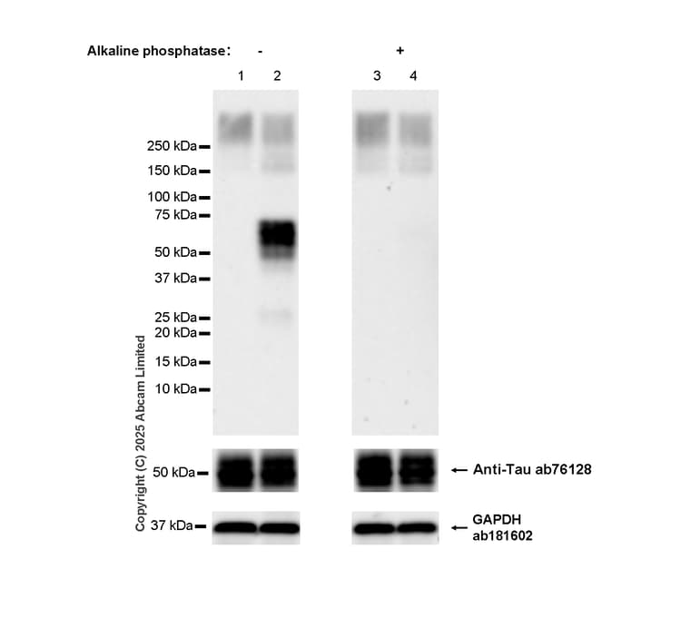 Anti-Tau antibody [EP2456Y](AB76128)