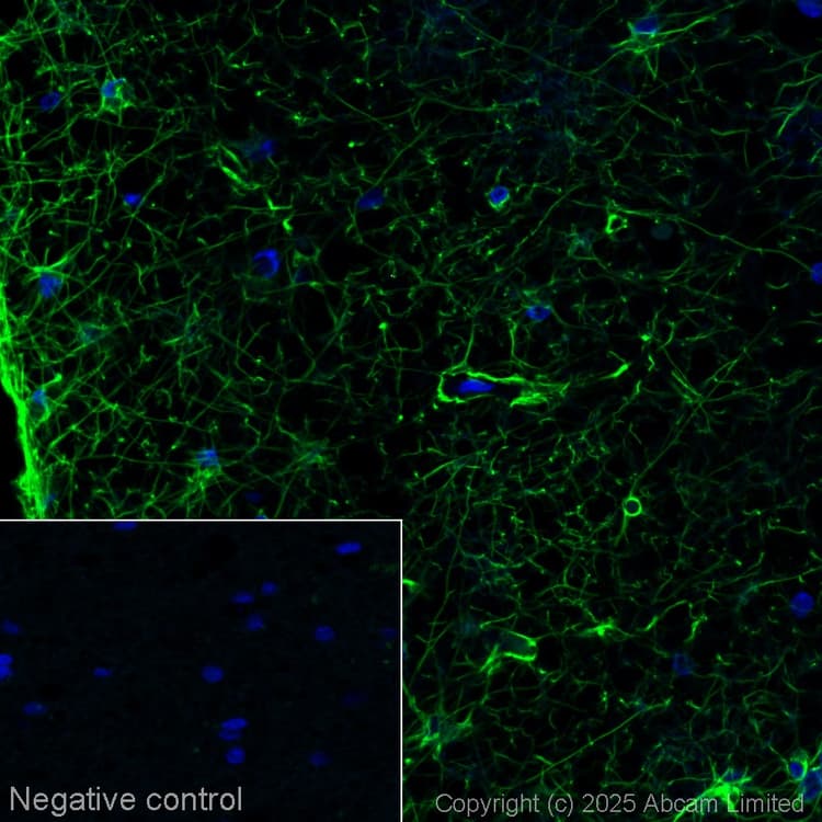 Alexa Fluor® 488 Anti-GFAP antibody [EPR1034Y](AB194324)