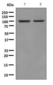 Gamma Adaptin Antibody Epr9875b Bsa And Azide Free Ab249398  Western Blot Img60919