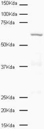 Rabbit Mouse Igg H L Hrp Ab6728 Western Blot Img92990
