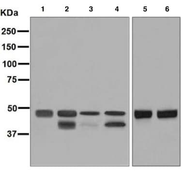 Anti-PTP1B + TCPTP antibody [EPR6712](AB129070)