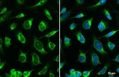 Anti-Calreticulin antibody(AB227444)