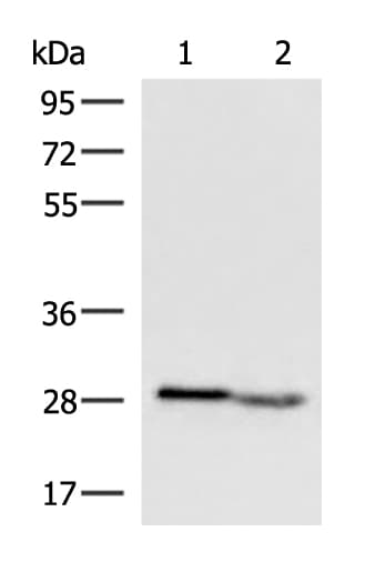 Anti-CD161 antibody(AB197979)