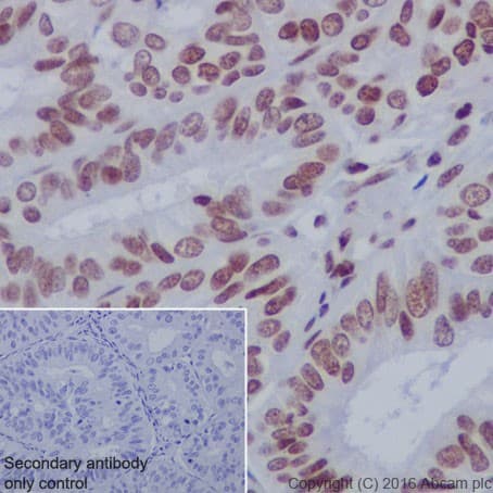 Anti-Histone H3 (acetyl K14) antibody [EP964Y] - ChIP Grade(AB52946)