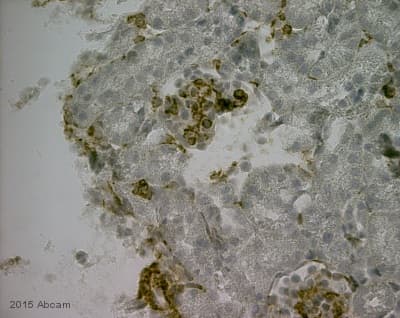 Anti-Desmin antibody - Cytoskeleton Marker(AB15200)