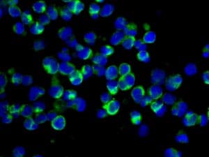 Sp17 Antibody Ep6496 Bsa And Azide Free Ab245780  Immunocytochemistry Immunofluorescence Img134295