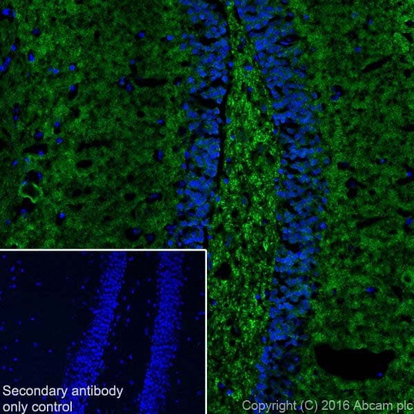 Anti-Alpha-synuclein antibody [EPR20535] - BSA and Azide free(AB225866)