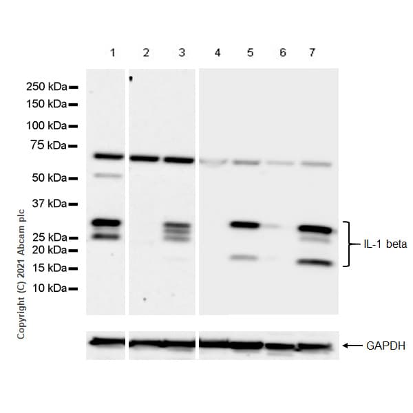 Anti-IL-1 beta antibody [RM1009](AB283818)