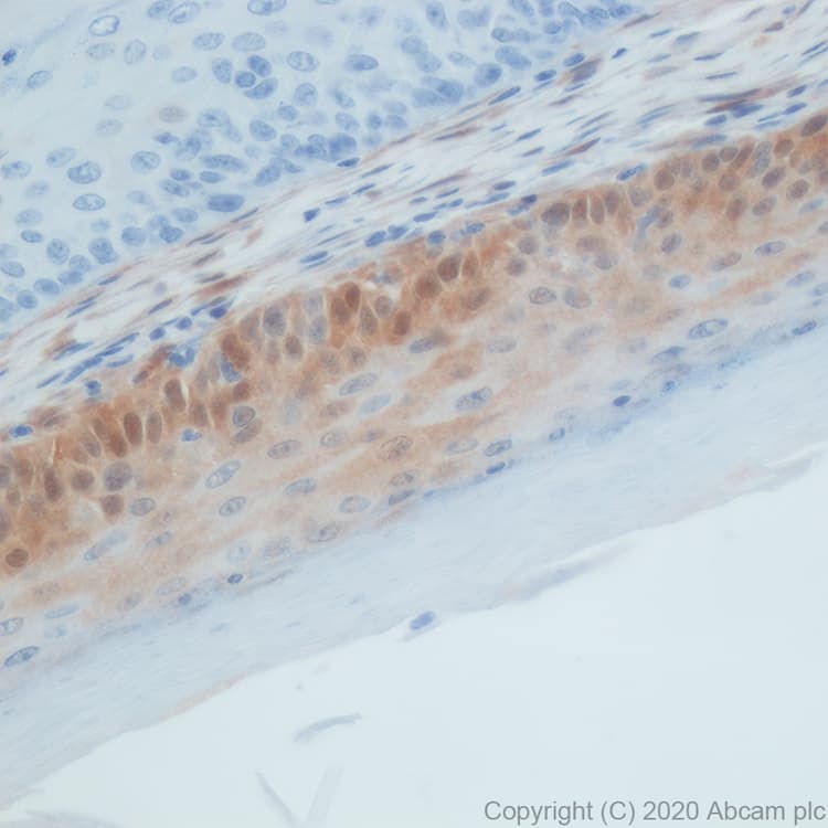 Anti-CDKN2A/p16INK4a antibody [PABLO33B](AB241543)