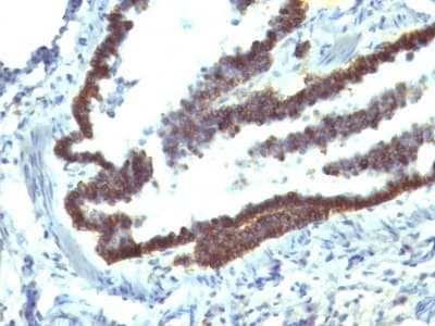 Anti-EpCAM antibody [EGP40/1110](AB233919)