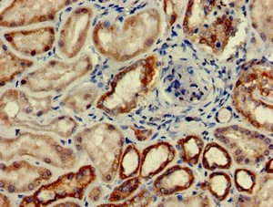 Anti-C6 antibody(AB229992)