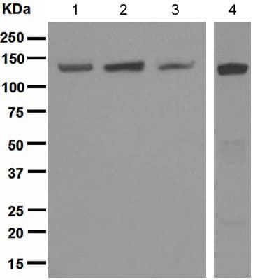 Anti-RENT1/hUPF1 antibody [EPR4681](AB109363)