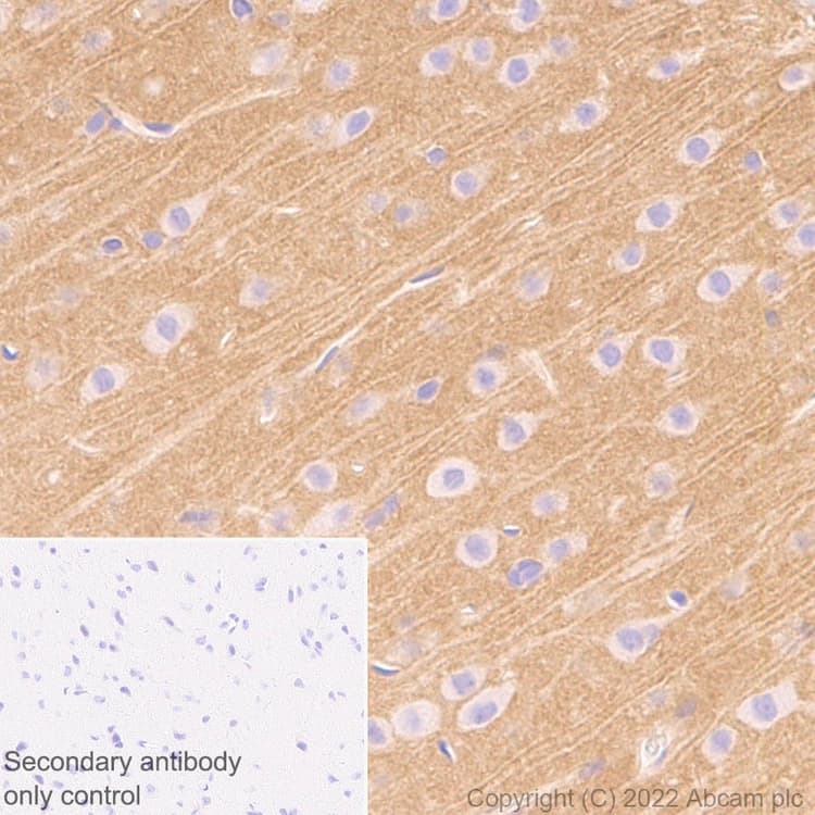 Anti-Sodium/calcium exchanger 2 antibody [EPR25106-37](AB300455)