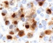 Pim2 Antibody Chu61b Ab107102  Immunohistochemistry Formalin Pfa Fixed Paraffin Embedded Sections Img82340
