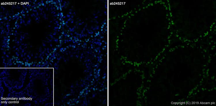Anti-DMC1 antibody [EPR23207-130](AB245217)