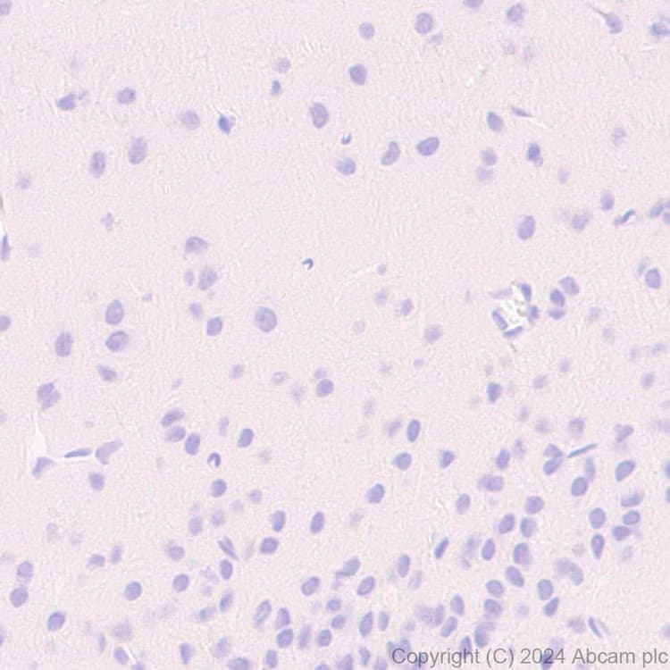 Anti-Pseudomonas Outer membrane porin F antibody [EPR28629-91](AB316973)
