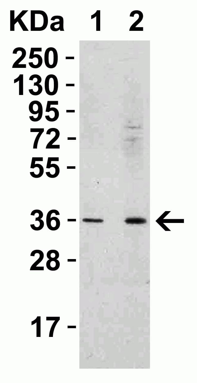 Anti-RSPO1 antibody(AB106556)