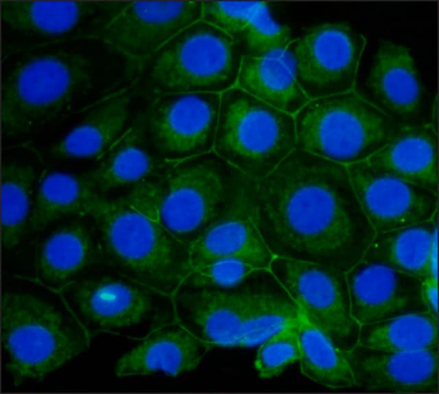 Anti-beta Catenin antibody(AB6302)