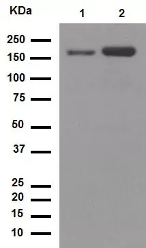 Anti-CD11b antibody [EPR1344](AB133357)