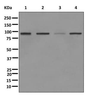 Anti-SUZ12 antibody [EPR5234(N)] - ChIP Grade(AB175187)