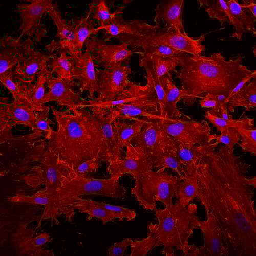 Anti-SSEA4 antibody [MC813-70](AB16287)