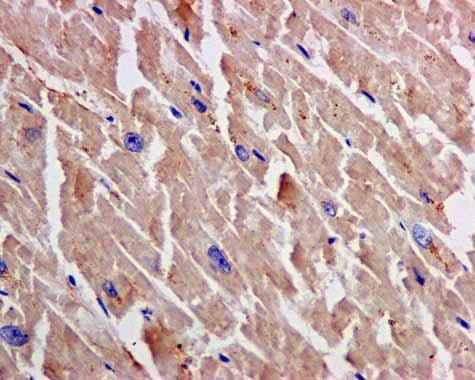Txnrd1 Antibody Epr10205 Ab167411  Immunohistochemistry Formalin Pfa Fixed Paraffin Embedded Sections Img67090