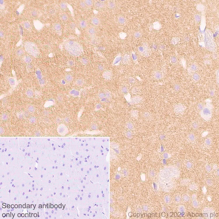 Anti-Calcineurin B/PPP3R1 antibody [EPR24992-18](AB303482)