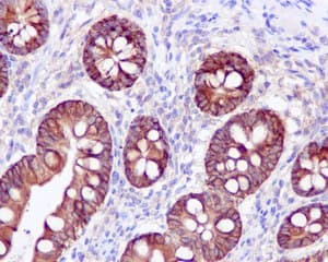 Anti-COX2 / Cyclooxygenase 2 antibody [EPR12012](AB179800)