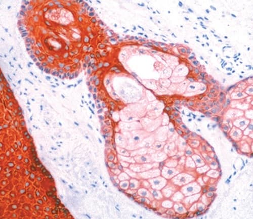Anti-pan Cytokeratin antibody [AE1/AE3 + 5D3](AB86734)
