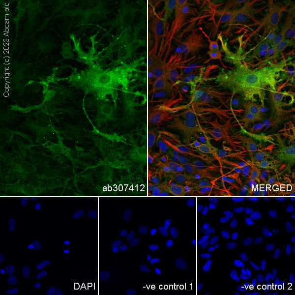 Anti-Aldolase C - C-terminal antibody [EPR26896-2] - BSA and Azide free(AB307413)