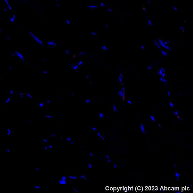 Alexa Fluor® 555 Anti-CD31 antibody [EPR17259](ab312892)