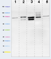 Anti-Pyruvate dehydrogenase E2/E3bp antibody [13G2AE2BH5](AB110333)