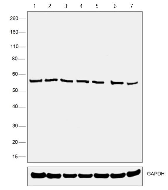 Anti-P4HB antibody [RL90](AB2792)