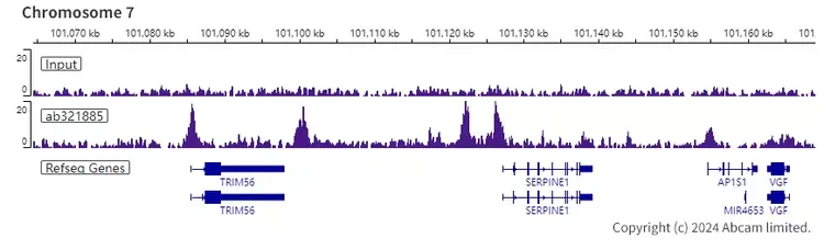 Anti-KAT2A / GCN5 antibody [EPR28321-83](AB321885)