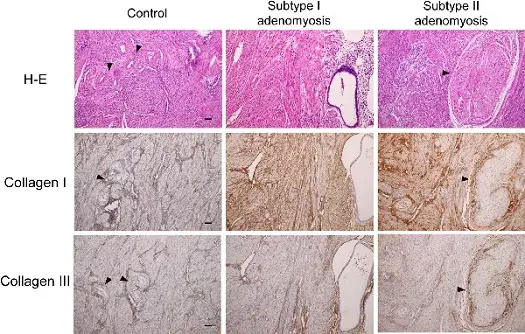 Anti-Collagen I antibody [EPR7785](AB138492)