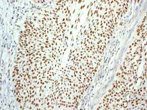 Anti-Cdk9 antibody [EPR3119Y](AB76320)