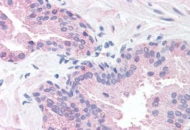 Slitrk6 Antibody Ab188813  Immunohistochemistry Formalin Pfa Fixed Paraffin Embedded Sections Img41135