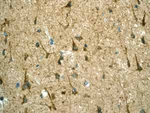 Anti-LRP1 antibody [EPR3724](AB92544)