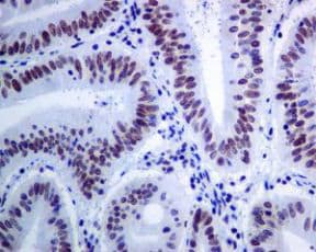 Brd4 Antibody Epr51502 Ab128874 Immunohistochemistry Formalin Pfa Fixed Paraffin Embedded Sections Img33867