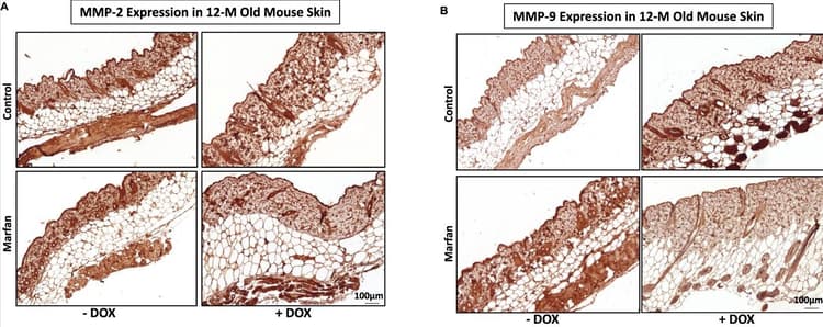 Mouse and Rabbit Specific HRP/DAB IHC Detection Kit - Micro-polymer(AB236466)