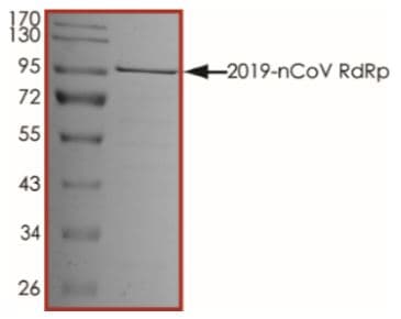 Recombinant human coronavirus SARS-CoV-2 RNA-dependent RNA polymerase (RDRP) protein (Active)(AB277617)