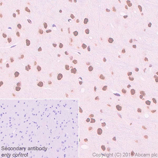 Anti-SMARCA2 / BRM antibody [EPR23103-44] - BSA and Azide free(AB269872)