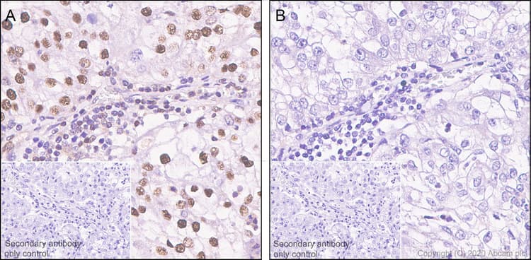 P27 Kip 1 Phospho S10 Antibody Ep2332y Ab62364  Immunohistochemistry Formalin Pfa Fixed Paraffin Embedded Sections Img130034