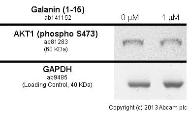 Anti-AKT1 (phospho S473) antibody [EP2109Y](AB81283)