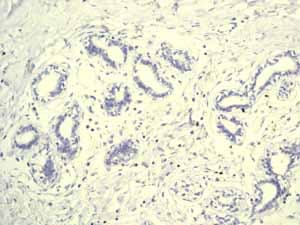 Anti-Lysozyme antibody [EPR2994(2)](AB108508)