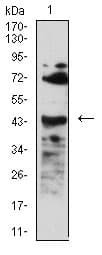 Baff R Antibody 5a9b6 Ab233775  Western Blot Img65178
