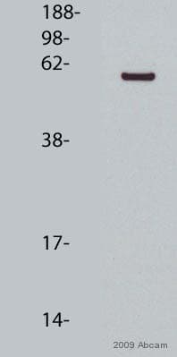 Anti-P4HB antibody [RL90](AB2792)