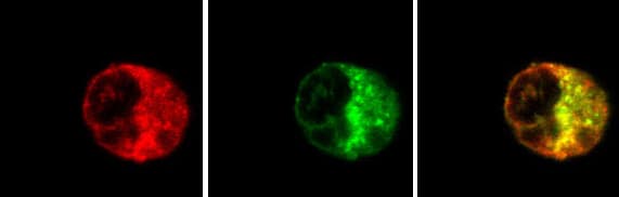 Rab5 Antibody Early Endosome Marker Ab13253  Immunocytochemistry Immunofluorescence Img60130