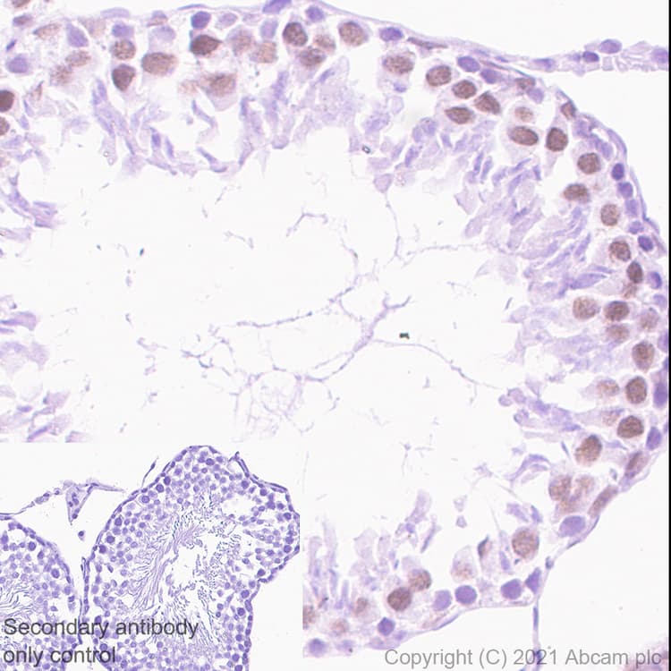 Ddx17 Antibody Epr13807b Ab180190  Immunohistochemistry Formalin Pfa Fixed Paraffin Embedded Sections Img165621